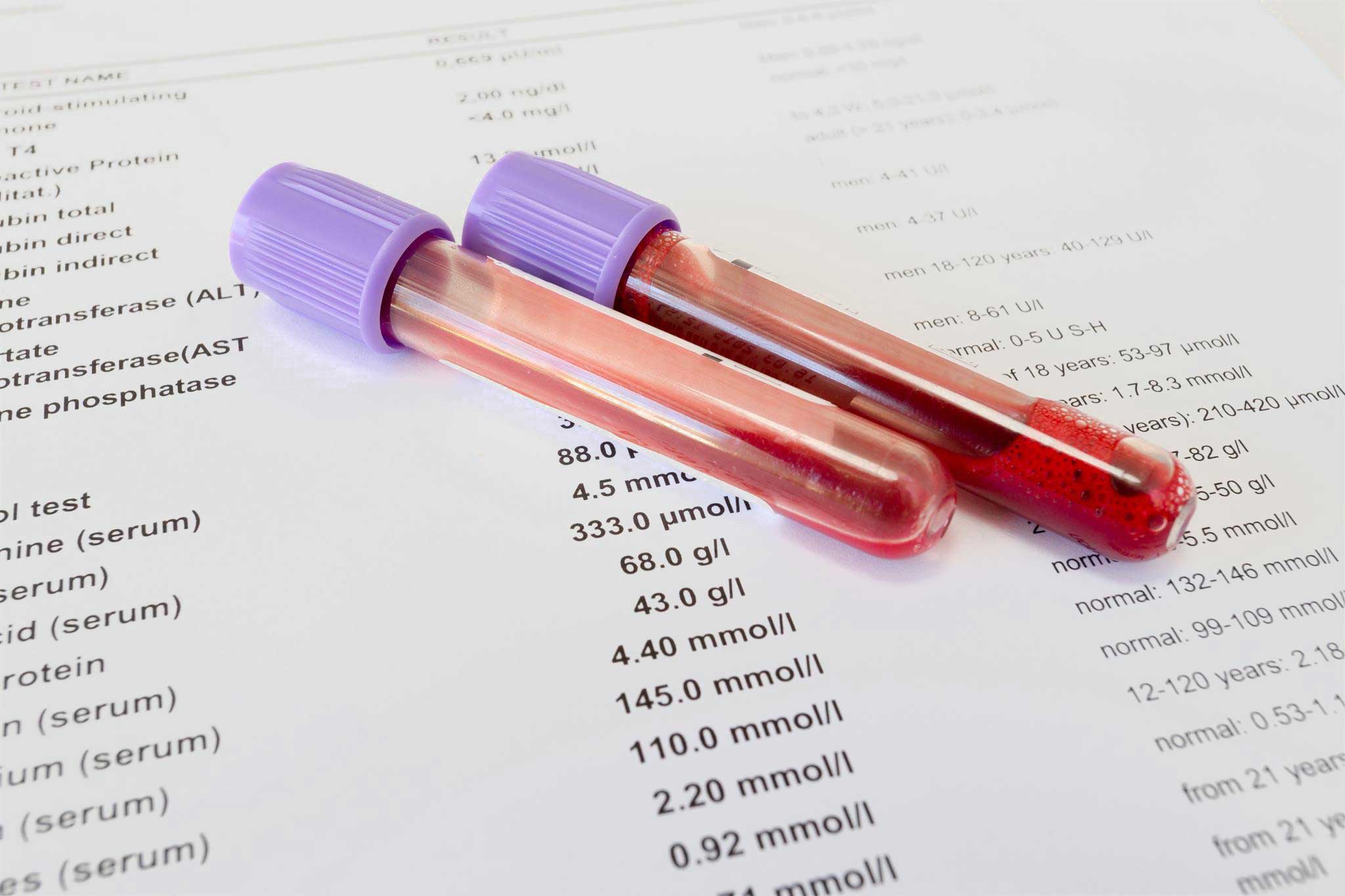 Biometric Screening Blood Test